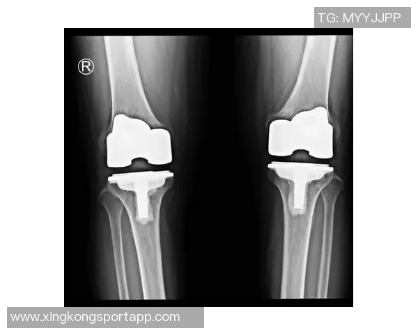 尤文图斯官方宣布卡巴尔右大腿肌肉受伤需两周后复查恢复情况
